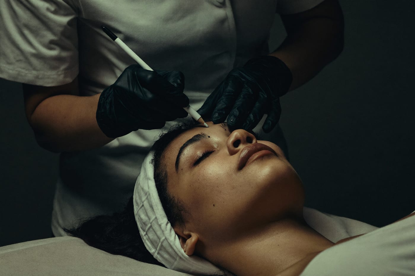 Avaliação dos pontos de aplicação antes da toxina botulínica